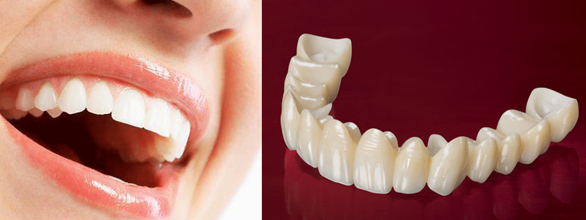 Zirconia Crowns | Cost of Zirconia Treatment | Jussmile.com